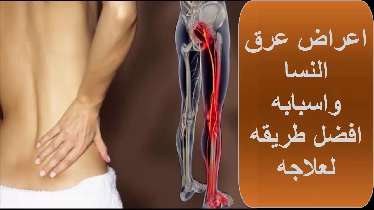 طرق علاج عرق النسا في الرجل اليسرى