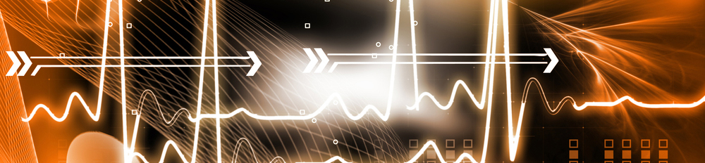 ECG Interpretation