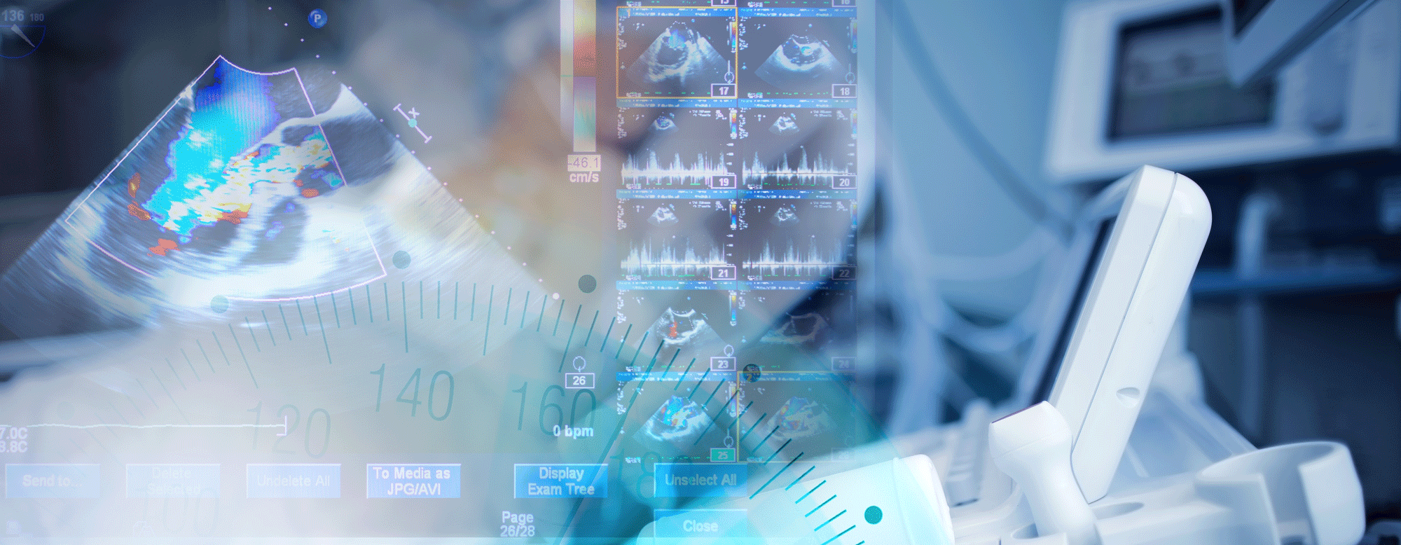 Point of Care Ultrasound