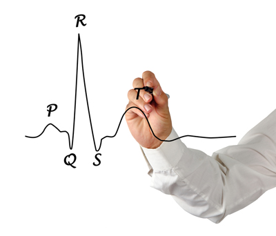 ECG